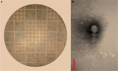 A novel Enterococcus faecium phage EF-M80: unveiling the effects of hydrogel-encapsulated phage on wound infection healing